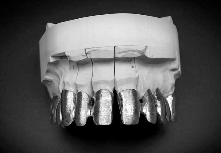 Podbudowa metalowa pod ceramikę - stal bezniklowa